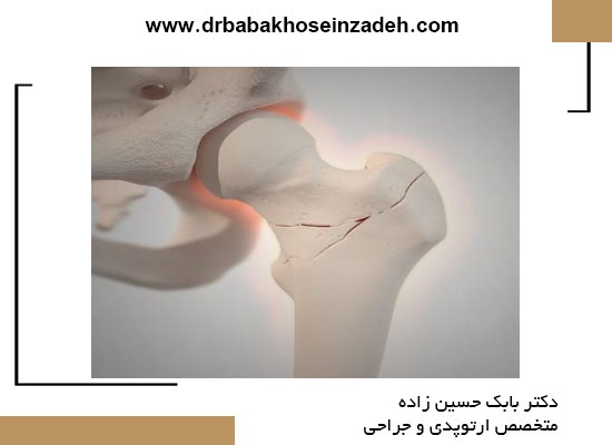 آشنایی با ساختار استخوان