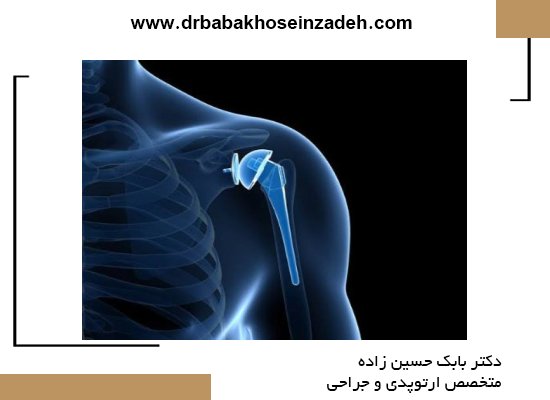 زمان جراحی تعویض کامل مفصل شانه