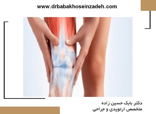 دلیل پاره شدن رباط صلیبی