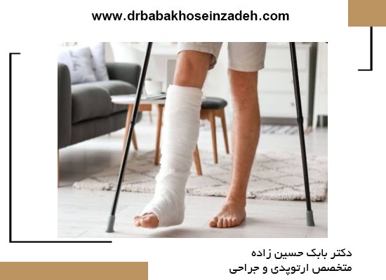 کنترل درد و کاهش ورم در شکستگی پا