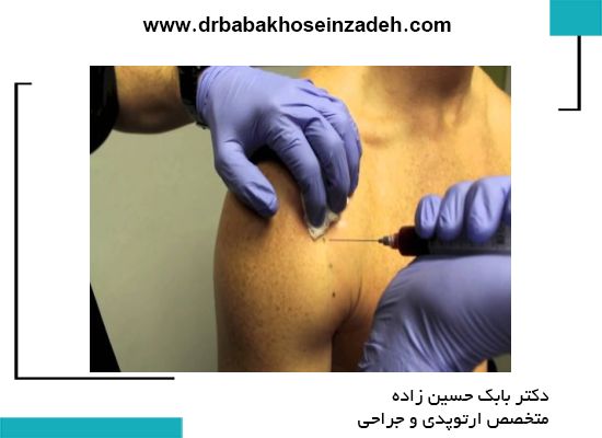 تزریق پی آر پی در مفصل شانه