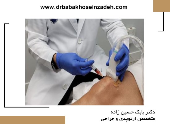 مراقبتهای قبل و بعد از تزریق پی آر پی