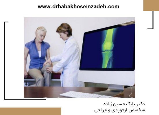 پیشگیری و کنترل آرتروز زانو