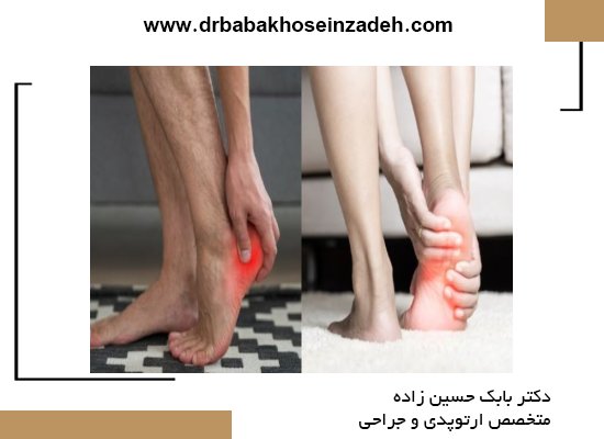 راهکارهای خانگی برای درمان خار پاشنه