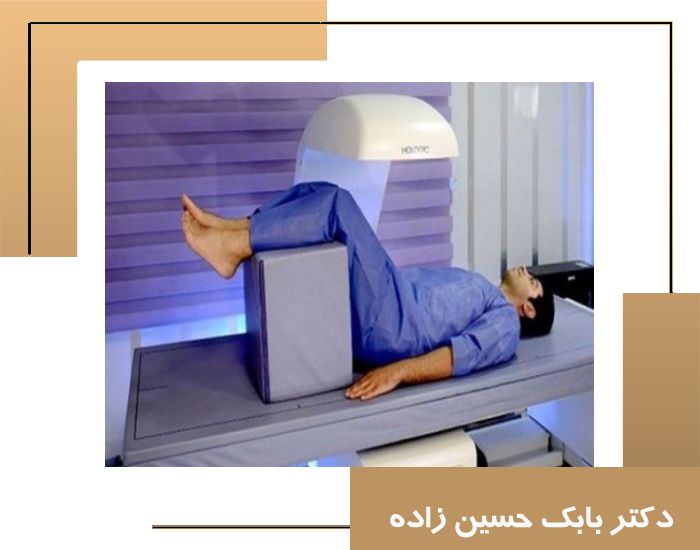 چه کسانی باید سنجش تراکم استخوان انجام دهند؟ راهنمای کامل