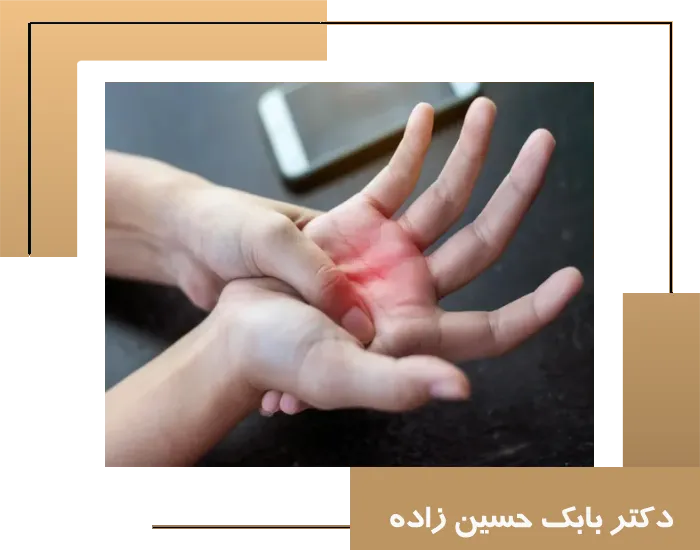 10 تمرین برای مشکل تنگی کانال مچ دست cts