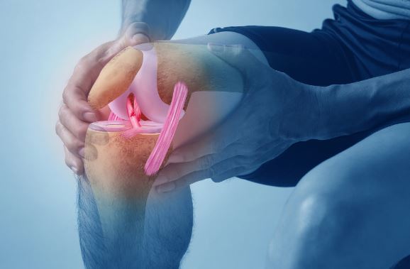 پارگی رباط صلیبی؛ علائم، دلایل، روش تشخیص و درمان قطعی