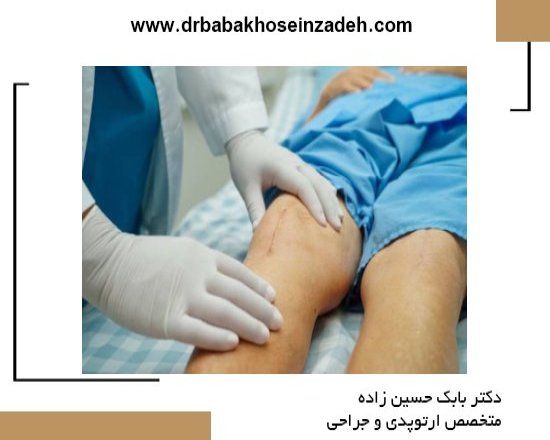 جراحی تعویض مفصل زانو چه زمانی ضروری است + مراقبت‌های طلایی بعد از عمل