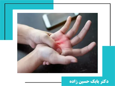 10 تمرین برای مشکل تنگی کانال مچ دست cts