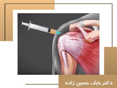 جدیدترین روش‌های تزریق برای درمان قطعی شانه یخ زده | همه آنچه باید بدانید
